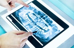 dental X-ray on tablet