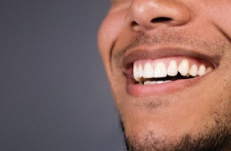 man smiling after working with a cosmetic dentist in Campbell