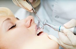 dentist in Campbell polishing a patient’s teeth