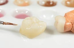 Tooth-colored dental crown prior to placement