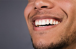 Man Smiling