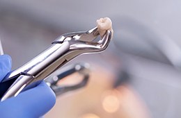 Tooth extractions vary in cost due to several important factors