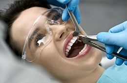 Factors that can affect the cost of tooth extractions include the location of tooth within the mouth