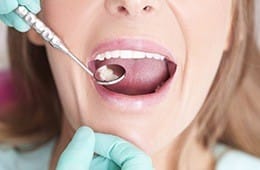 Closeup of smile during dental exam