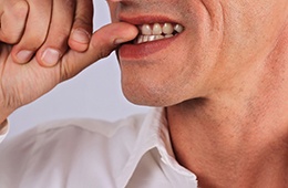 Man with dental implants in Campbell, CA biting his fingernails