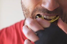 Man with dental implants in Campbell, CA putting in a mouthguard