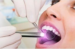 Closeup smile during oral cancer screening