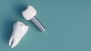 dental implants against a blue background