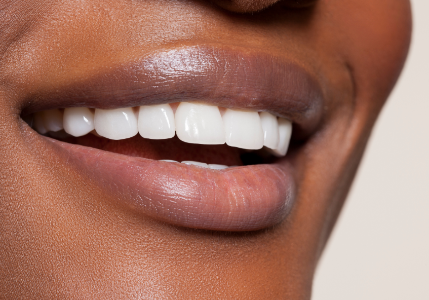 Close up of woman's smile